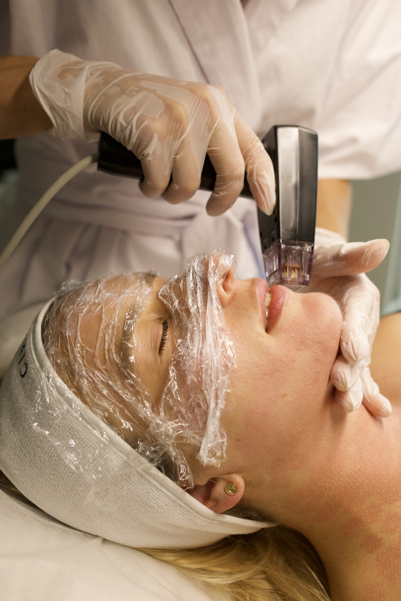Morpheus8 technology and treatment concept
