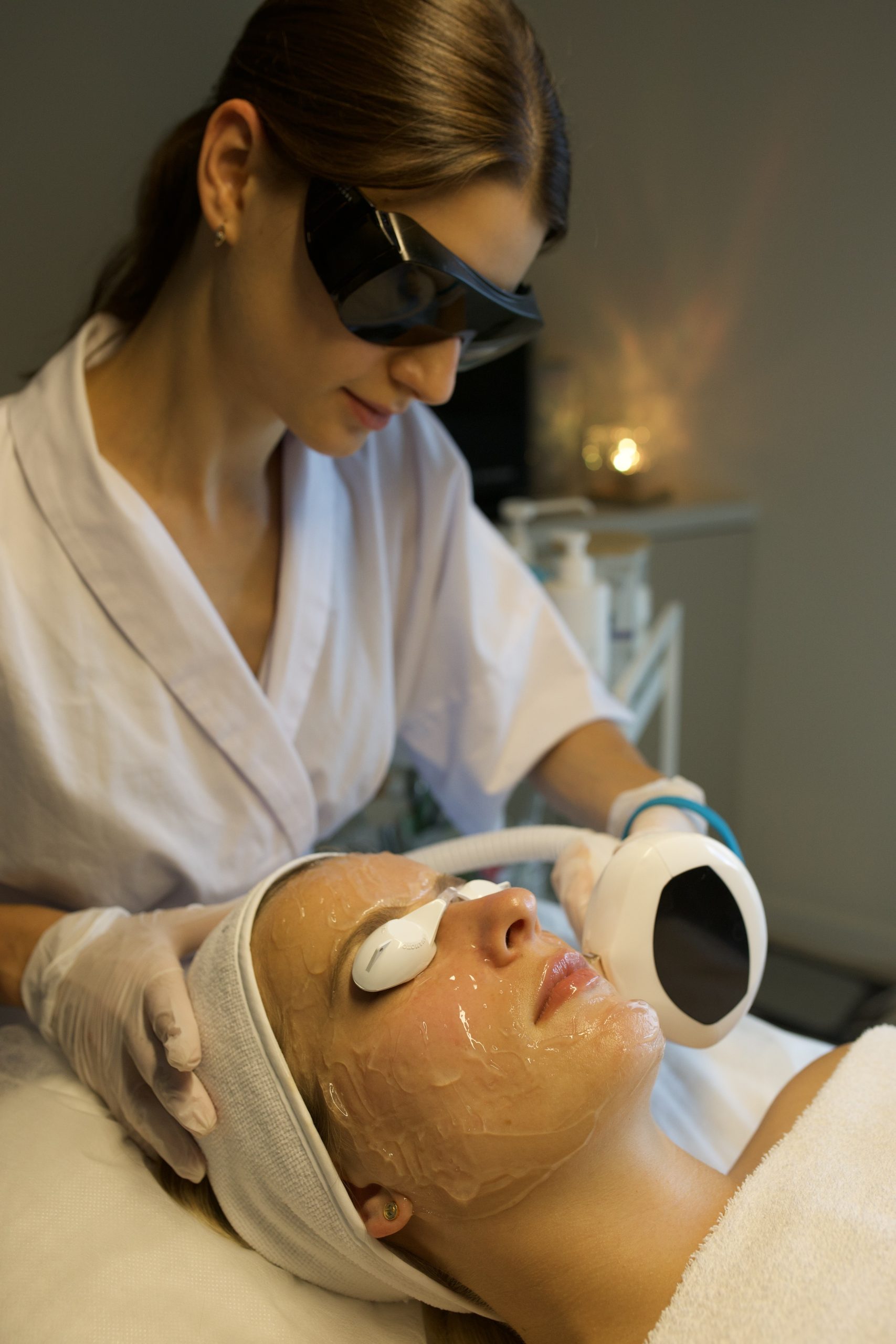 Lumecca IPL before and after