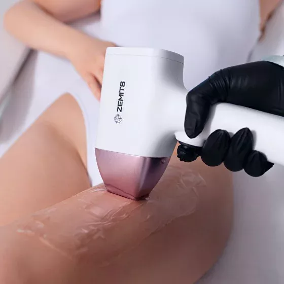 Zemits DioPulse laserontharing behandeling bij Skin Gallery