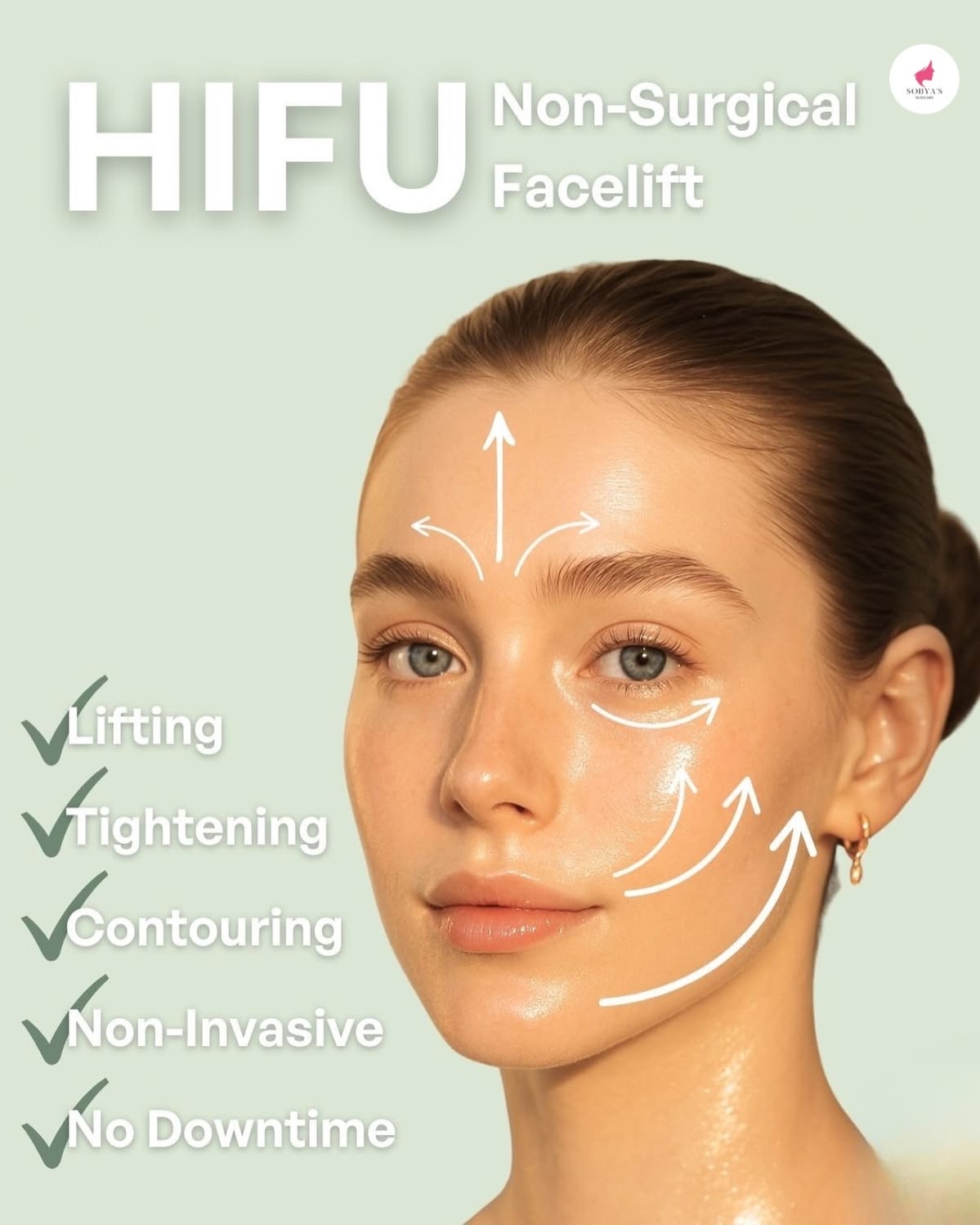 HIFU lifting result concept