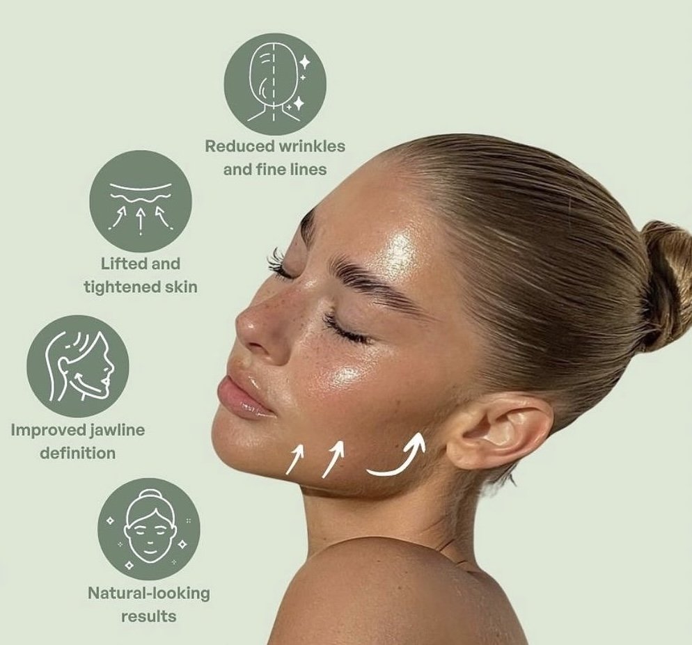 HIFU treatment areas